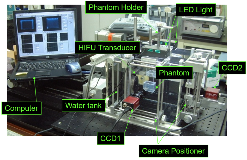 A quality assurance tool kit for HIFU surgery 자료 이미지